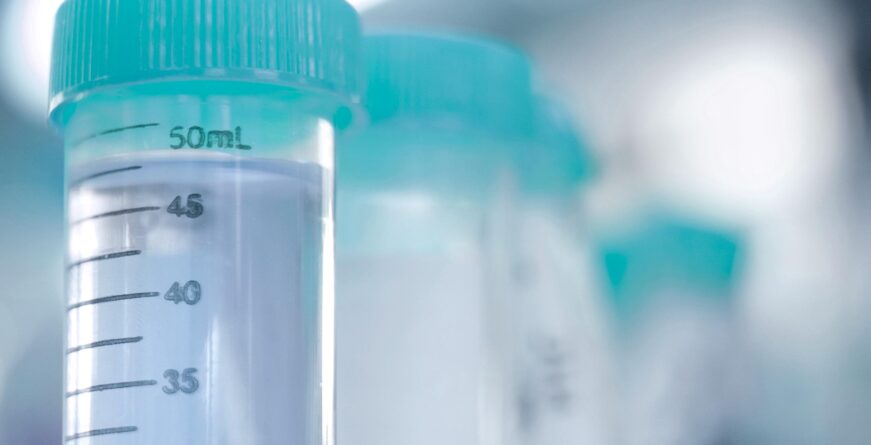 LABS CAROUSEL HORMONE TESTING 871x445