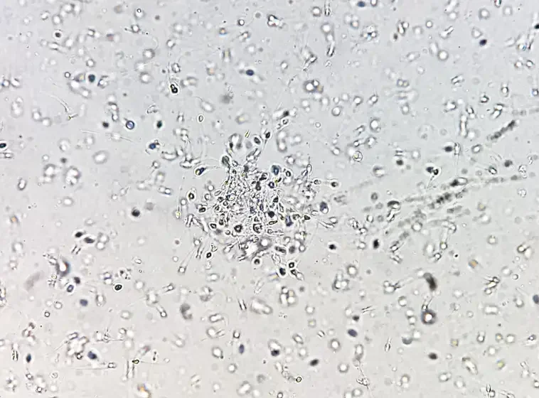 img maze s unique approach sperm mapping 2x